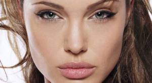 angelina-jolie-prp-treatment-injection angelina-jolie-prp-treatment-injection