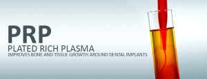 Dental Implants and PRP Treatments