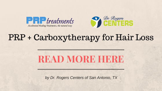 PRP + Carboxytherapy for Hair Loss by Dr. Rogers Centers