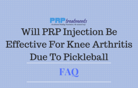 Will PRP Injection Be Effective For Knee Arthritis Due To Pickleball